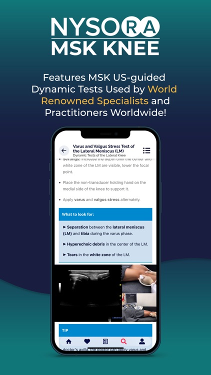 NYSORA MSK US Knee screenshot-3