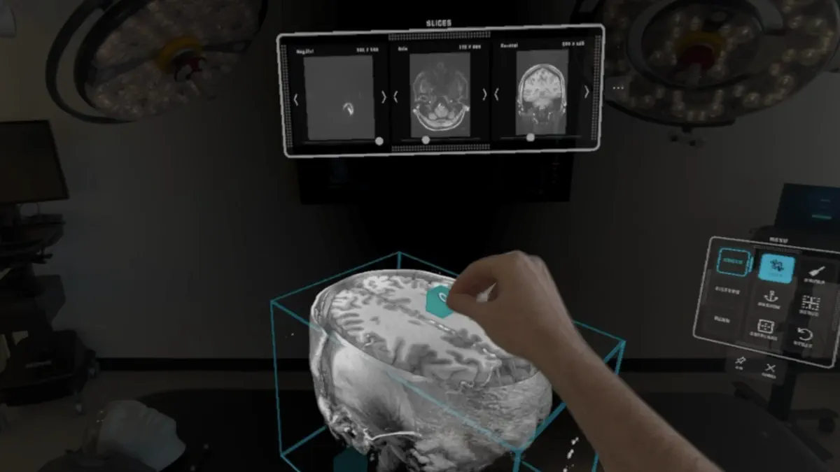 SurgicalAR Viewer screenshot 1