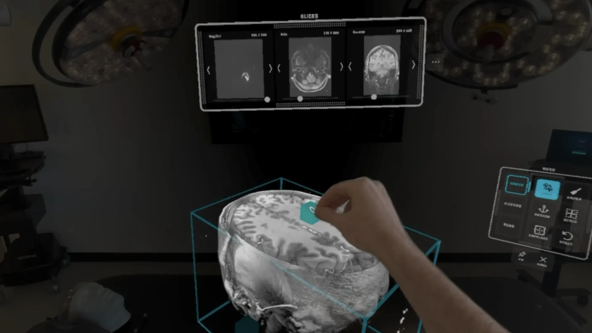 SurgicalAR Viewer screenshot