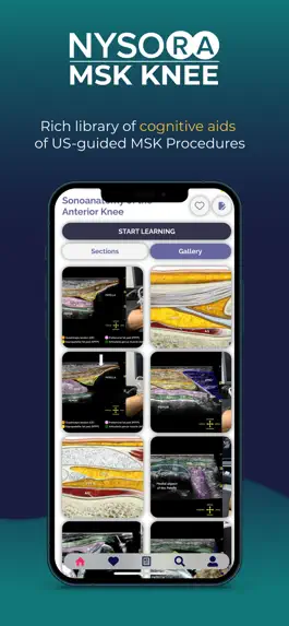 Game screenshot NYSORA MSK US Knee apk