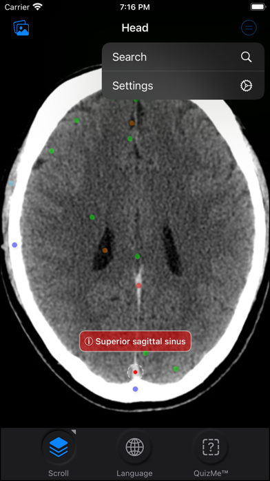 CT Anatomy Screenshot