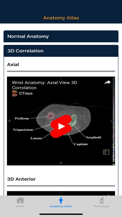 CTisus: CT of the Hand & Wrist screenshot-3