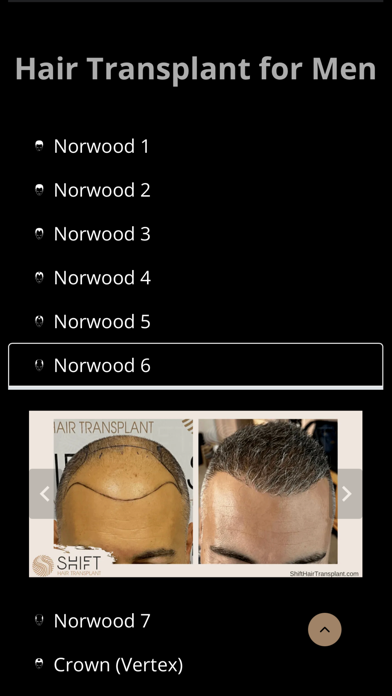 SHIFT Hair Transplant Screenshot