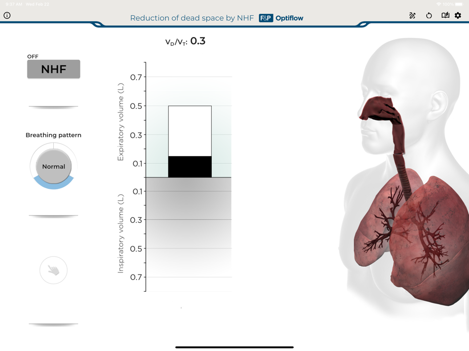 F&P NHF Dead Space (iOS) 由: Fisher & Paykel Healthcare