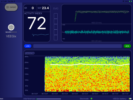 Screenshot #5 pour VEEGix EEG