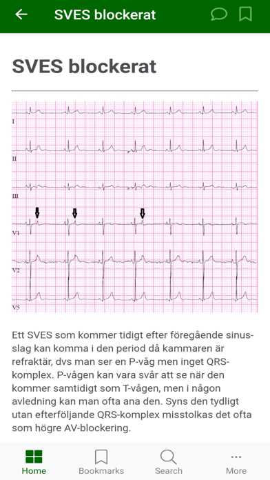 EKG APPEN Screenshot