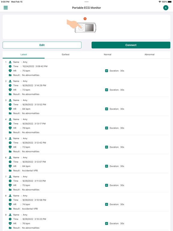 EMAY Portable ECG Monitor