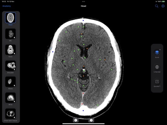 CT Anatomyのおすすめ画像1