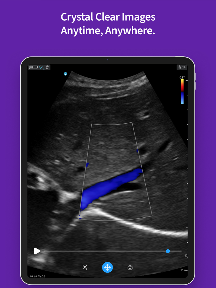 Vscan Air VET Ultrasound