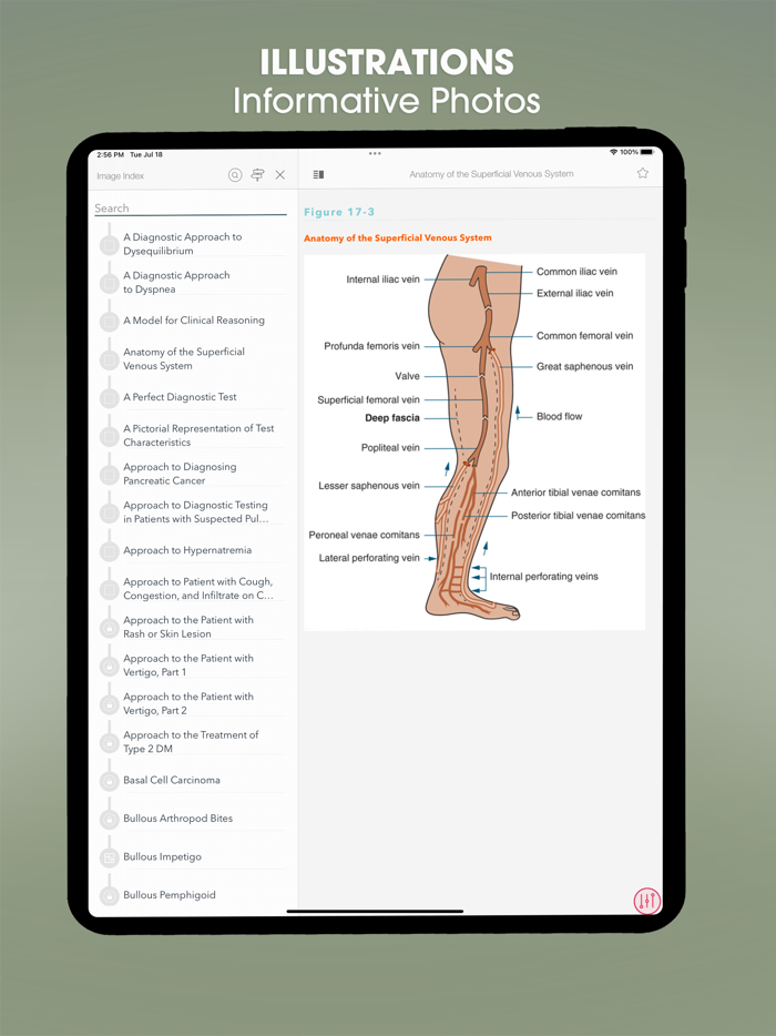 Symptom to Diagnosis EB Guide