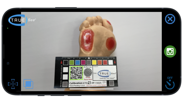 TRUE-See® Mobile App