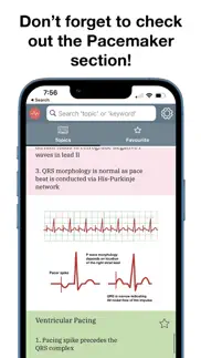 ecg stat iphone screenshot 4