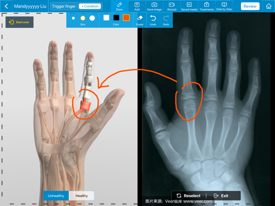 Always Health iPad screenshot 3 - Medical app