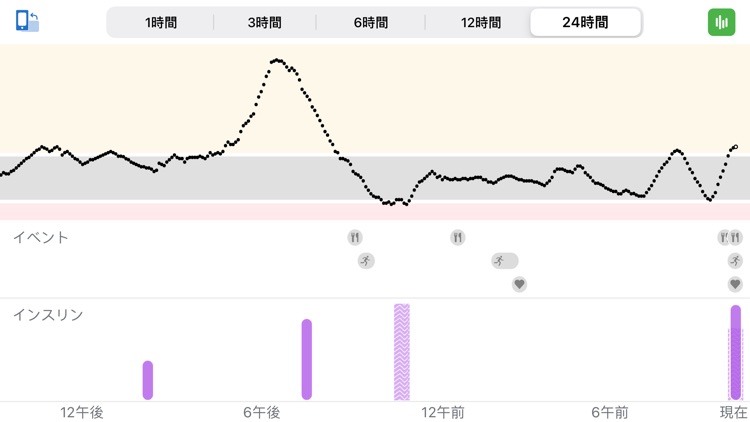 Dexcom G6 mg/dL DXCM10