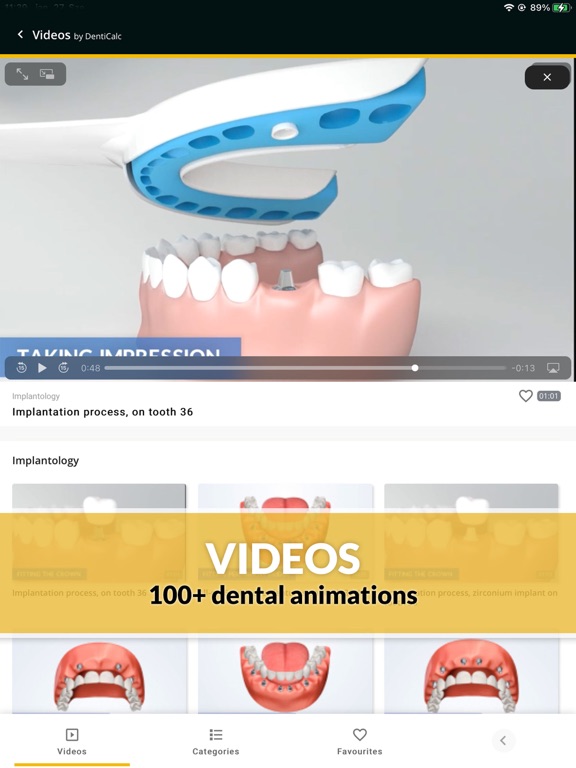 Screenshot #6 pour DentiCalc - the dental app