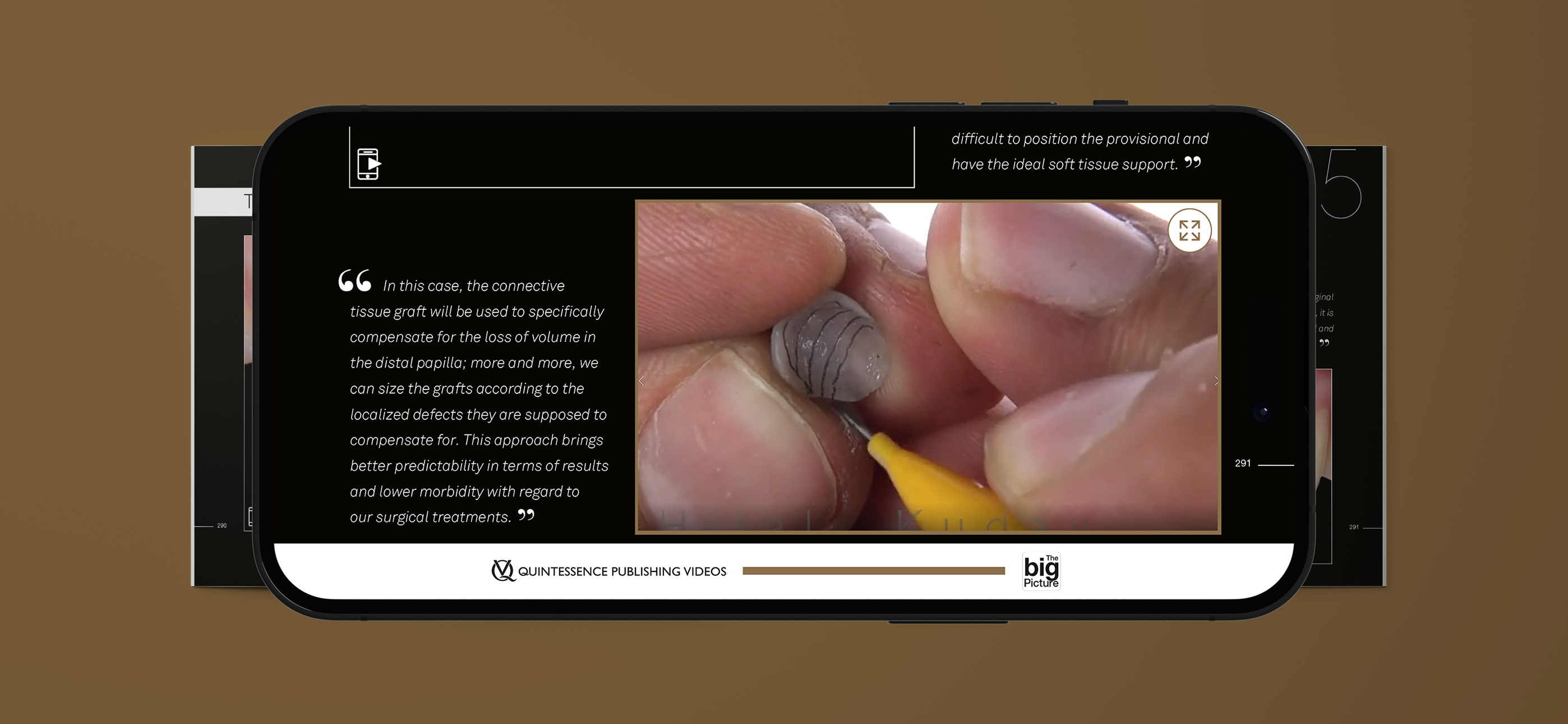 Quintessence The big Picture