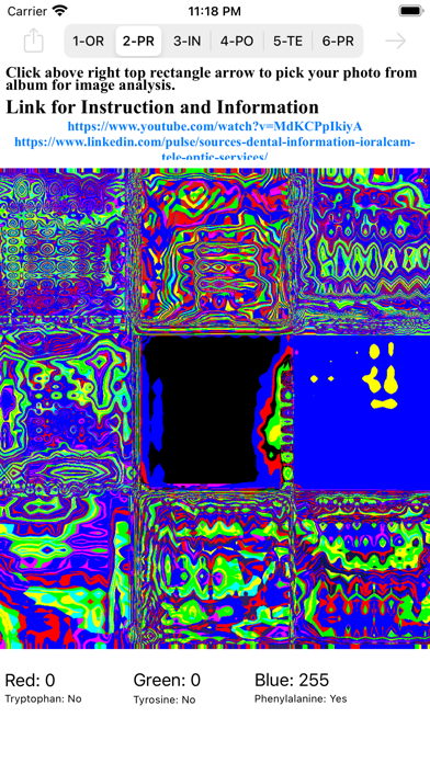 EZdiag