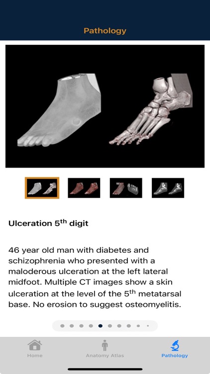 CTisus: CT of the Foot screenshot-5