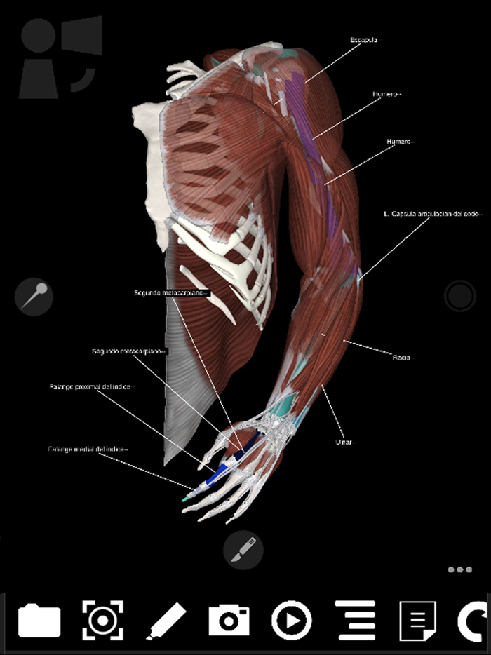 3Dissect Upper Limb