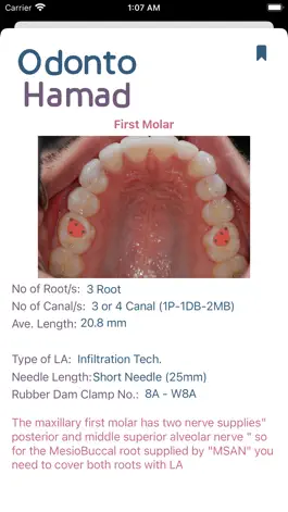 Game screenshot OdontoHamad-Endodontics helper hack