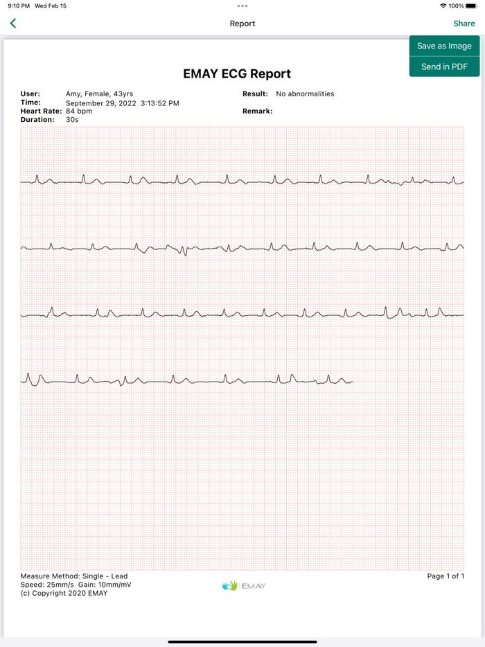 EMAY Portable ECG Monitor