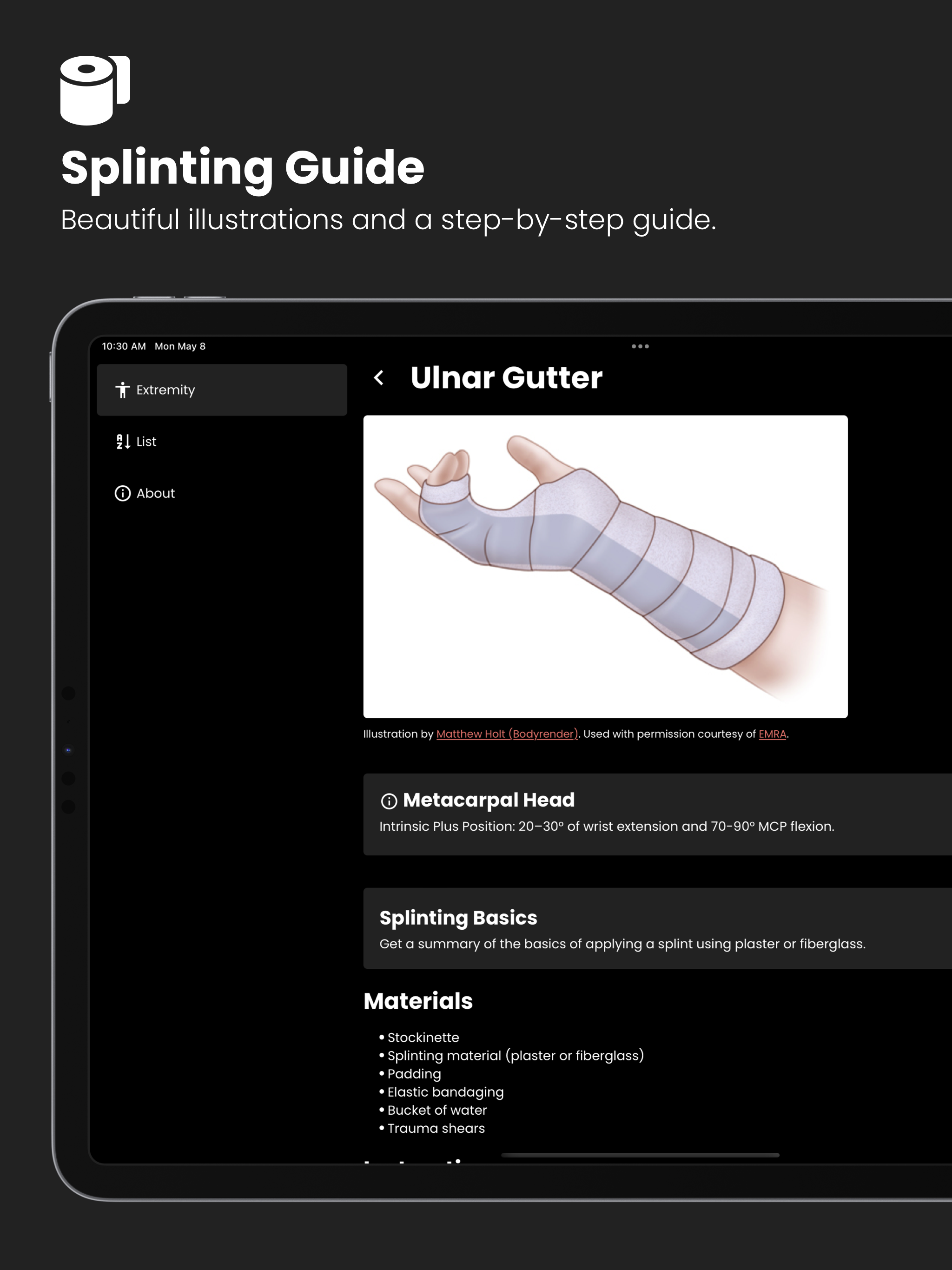 Fractures: Splinting App