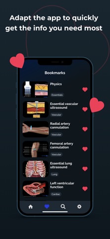 Point of Care Ultrasoundのおすすめ画像7