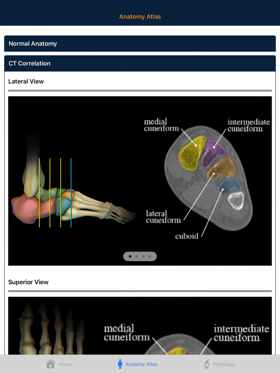 CTisus: CT of the Foot iPad screenshot 4 - Medical app