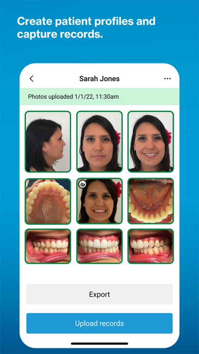 Invisalign Practice App Screenshot