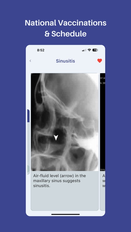 Medinfo: Medical Information screenshot-8