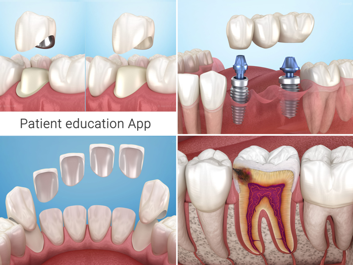 Dental 3D Illustrations