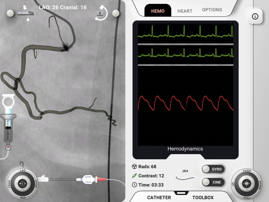 AngioAID 3D iPad screenshot 4 - Medical app