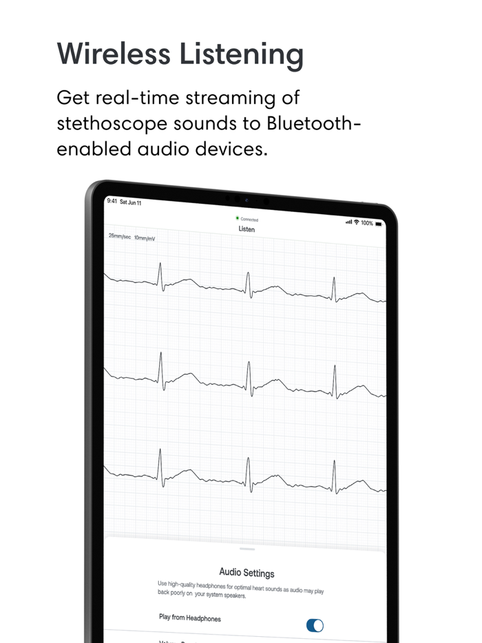 Eko Digital Stethoscope  ECG