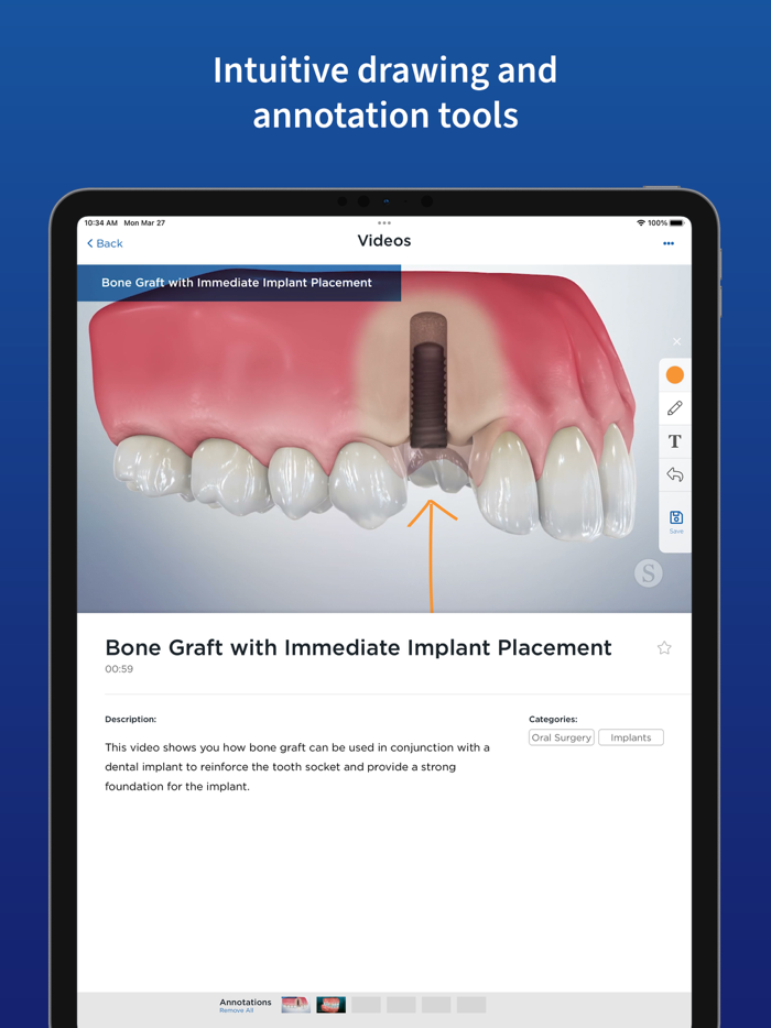 Spear Patient Education