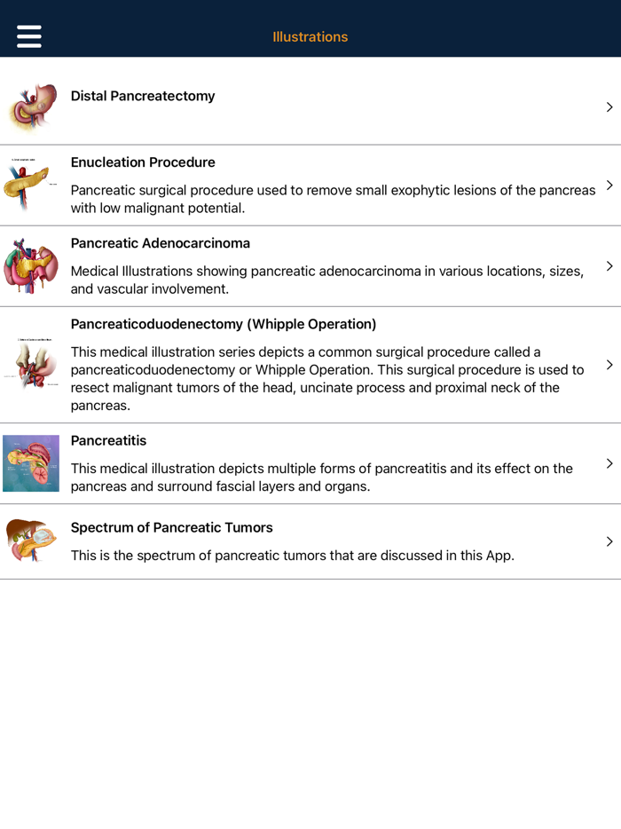 CTisus Pancreas Compendium