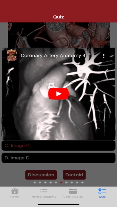 CTisus CT Coronary Arteries Screenshot