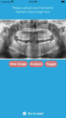 Game screenshot DentalScanner apk