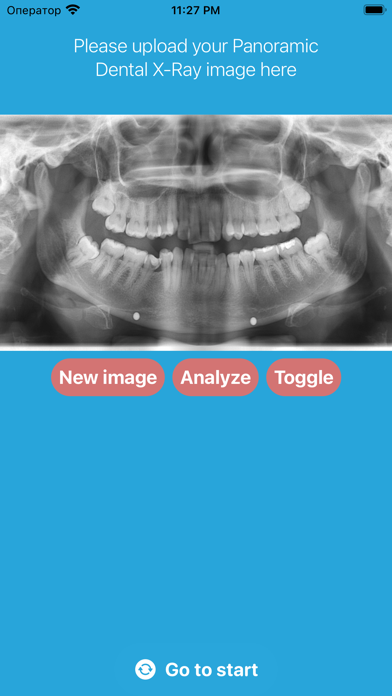 DentalScanner Screenshot