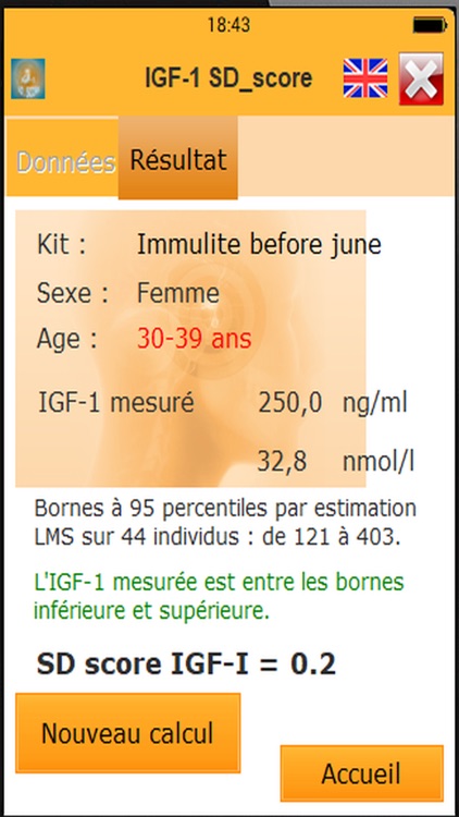 IGF1SDS