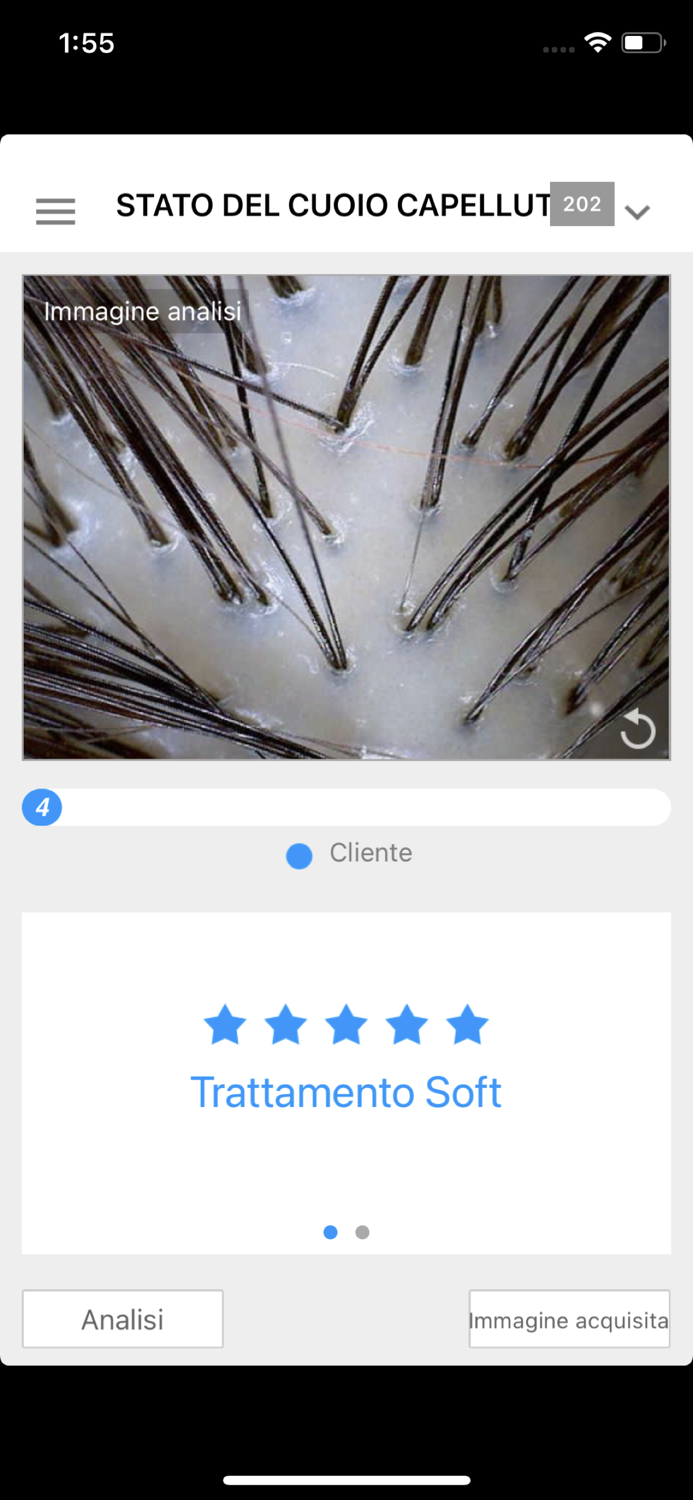 EODIS Hair and Scalp Scanner