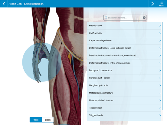 Always Health iPad screenshot 4 - Medical app