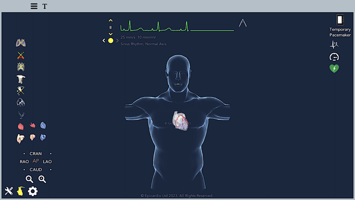 Temporary Cardiac Pacing