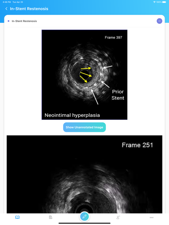 IVUSAID iPad screenshot 3 - Medical app