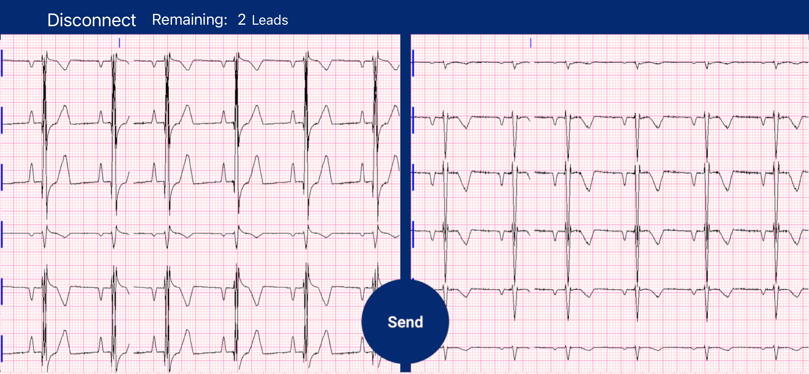 MyRhythm Connect