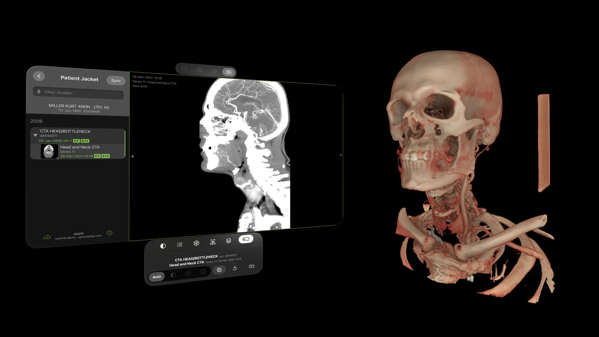 Visage Ease VP screenshot 1