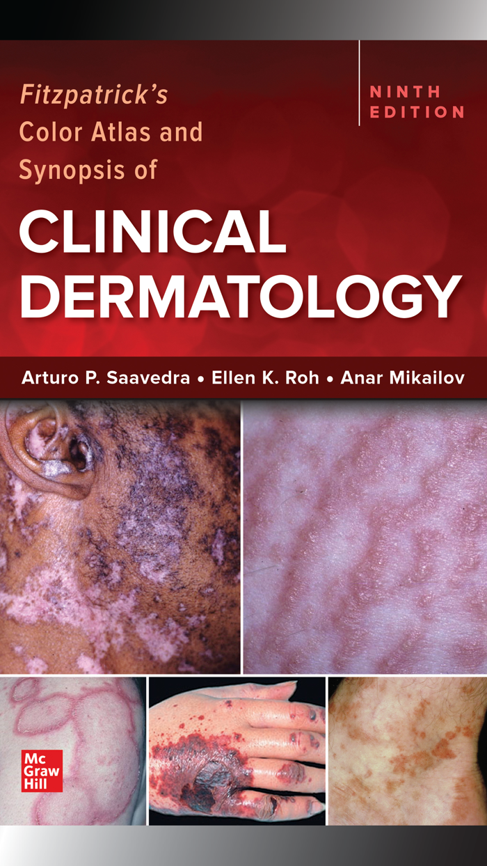 Fitzpatricks Atlas-Synopsis 9E