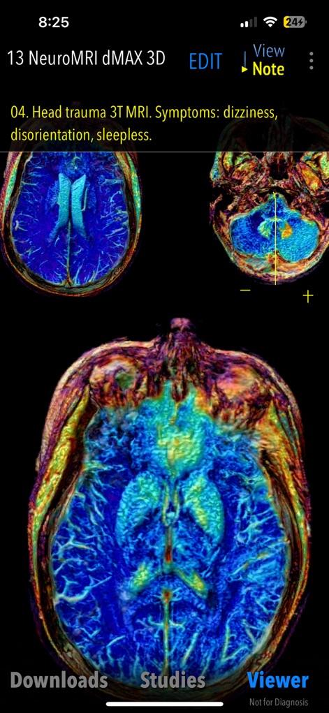 MedVizi™ CT-MRI Viewer - Medical App | MWM