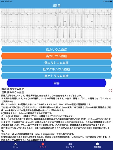 みんなde心電図のおすすめ画像5