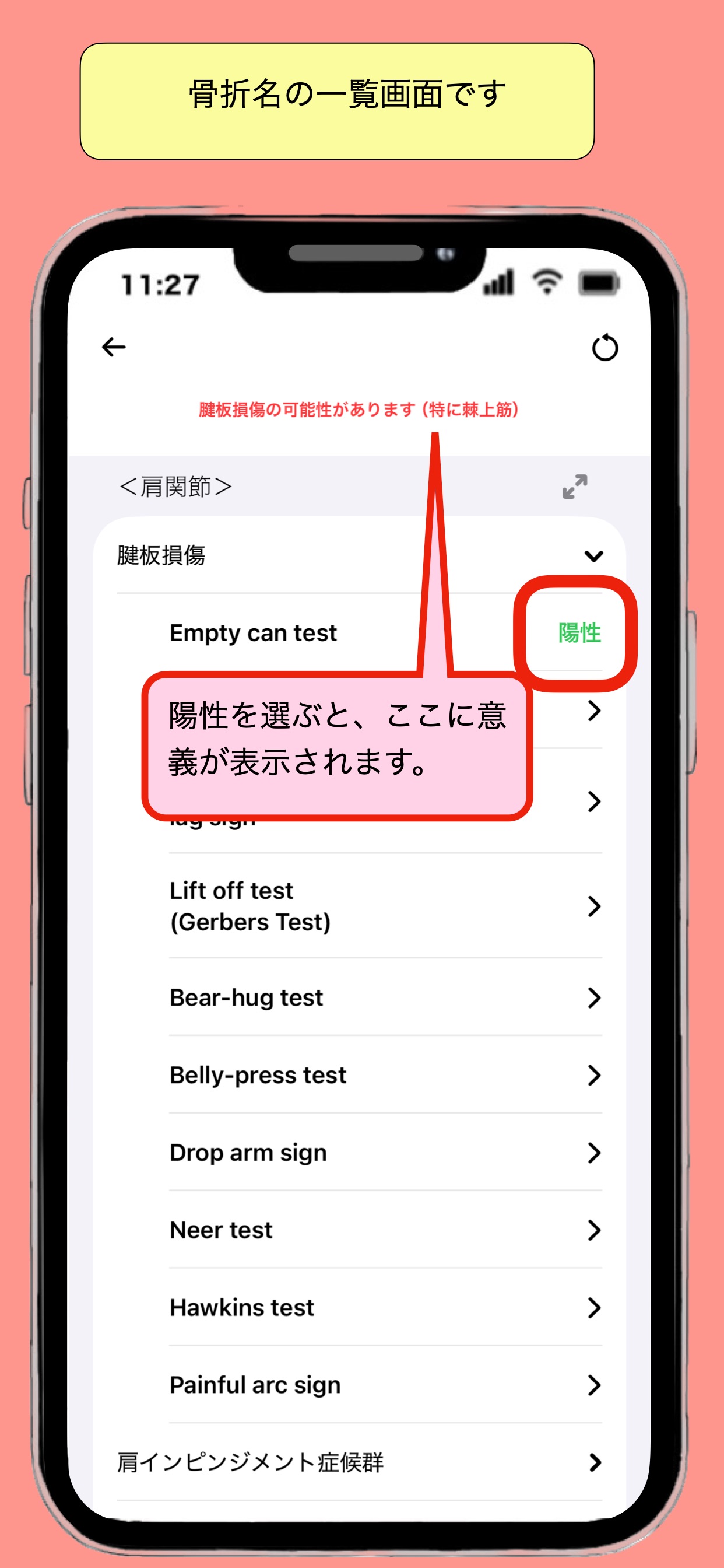 Screenshot 9 of 整形外科治療ガイド_骨折から理学所見まで