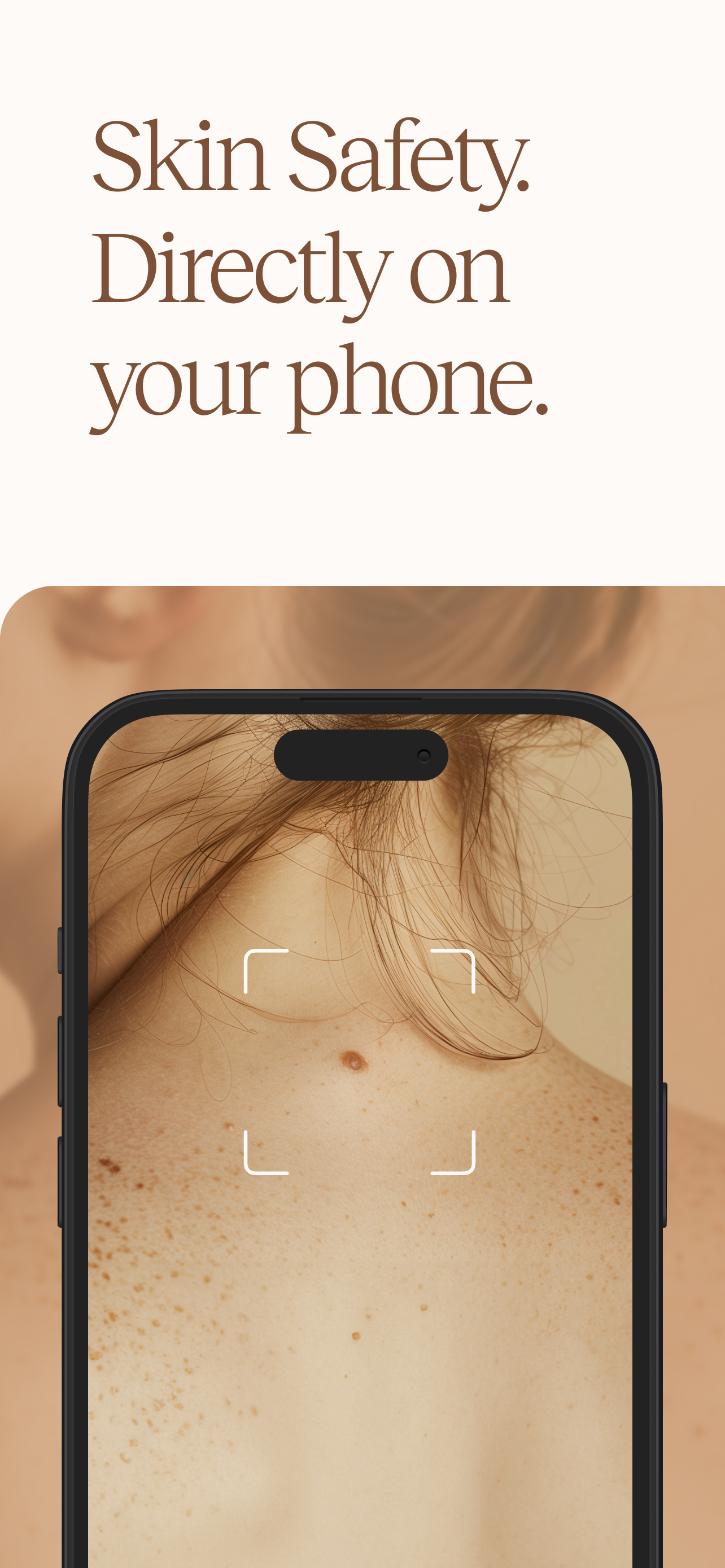 Oteria - Skin Cancer Check